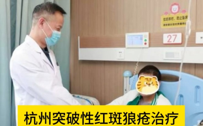 红斑狼疮治疗在杭州实现重大突破，已为20名患儿成功治疗