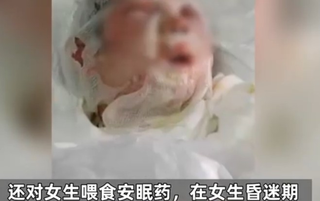 绑架前女友泼开水致其毁容，长达两天两夜残忍折磨